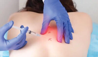 Trigger Point Injection Therapy for Chronic Pain