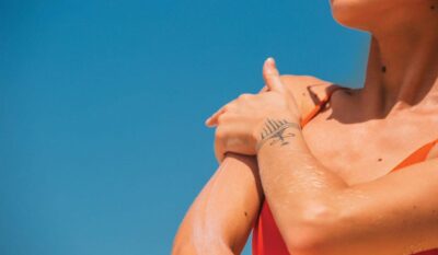 What are skin tags – and how can they be removed?