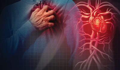 Cardiovascular Disease: A Nutritionist’s Approach to Prevention and Management