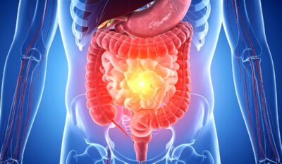 Functional Medicine Tests