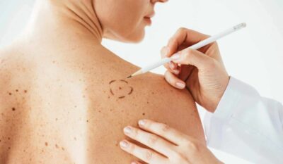 General Dermatology