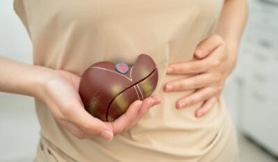 Who Should Have a Liver Elastography (Liver Fibrosis Scan) Assessment? What Does It Involve?