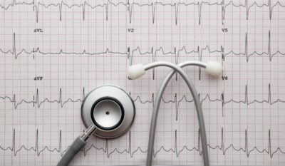 Paediatric ECG (Electrocardiogram)