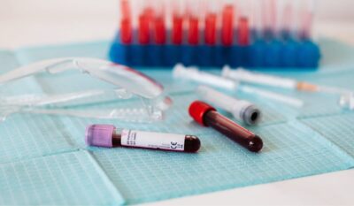 COVID-19 Spike Protein Antibody Test