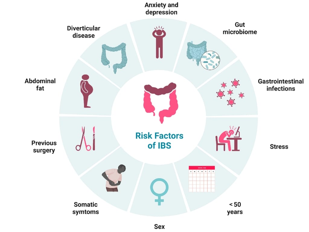 Risk factors of irritable bowel syndrome