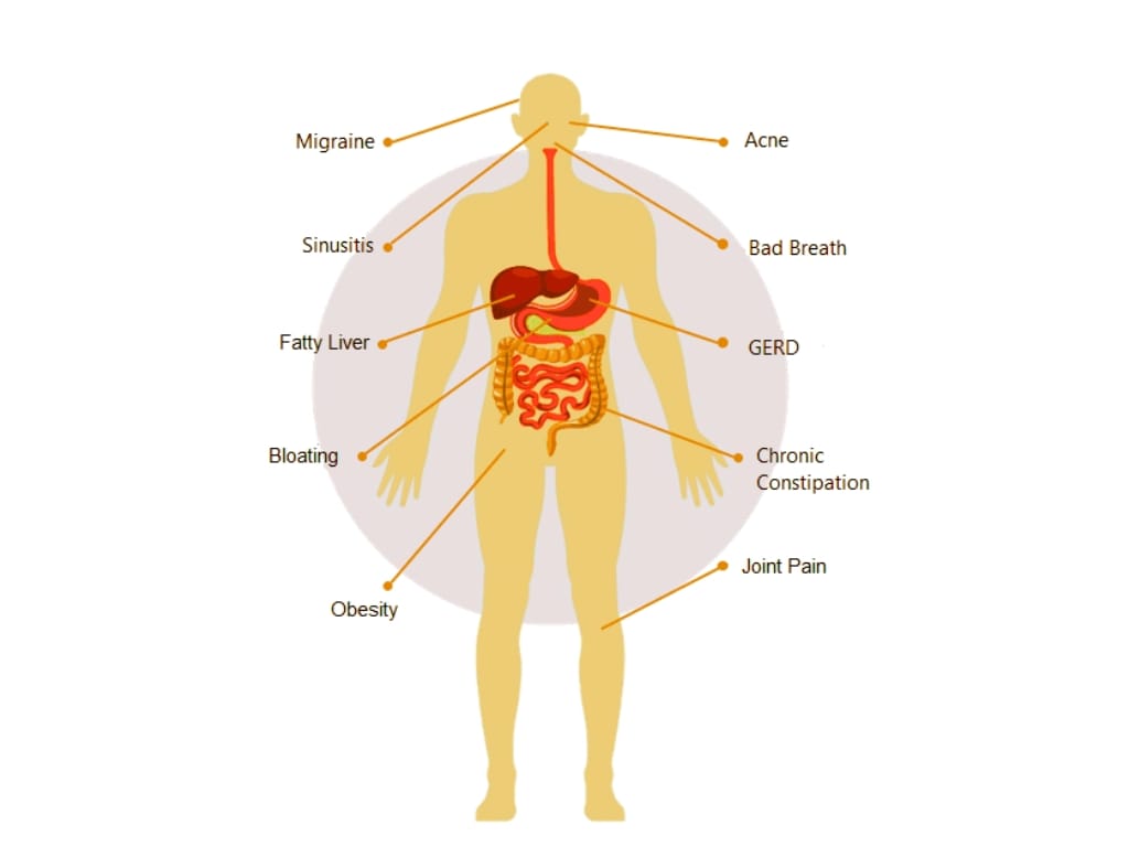 The Symptoms People Associate with “Leaky Gut”