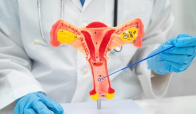 Top 5 Reasons Why Cervical Smear Tests Are Important for Women