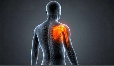 Shoulder Hydrodilatation