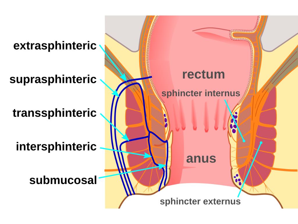 Anorectal Surgery