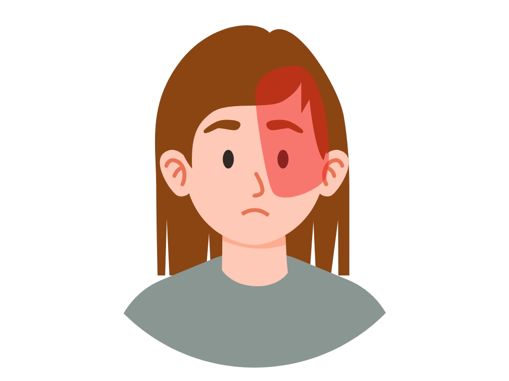 migraine with aura