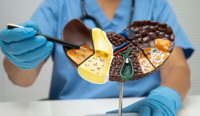 Fatty Liver Disease: Why Early Liver Scanning Matters More Than Ever