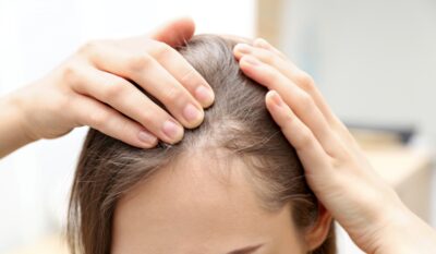 Hair Thinning & Scalp Health Treatment
