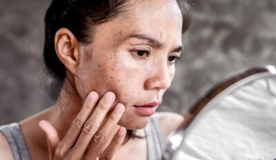 Skin Concerns We Treat