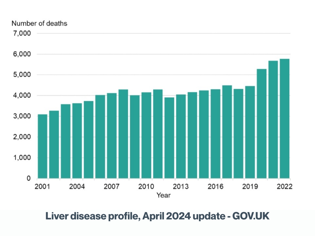Liver disease profile, April 2024 update - GOV.UK